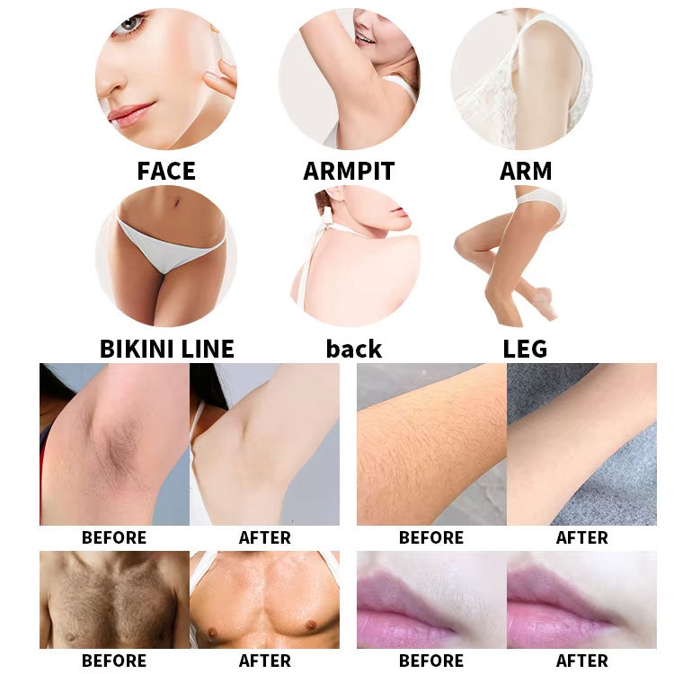 Opt Ipl / Shr / Ipl Multifunctional Machine Portable Shr Fast Hair Removal