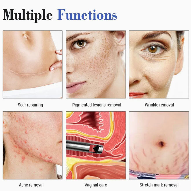 3 in 1 Fractional Laser Skin Rejuvenation Acne Scar Removal Vaginal Tightening CO2 Laser Machine
