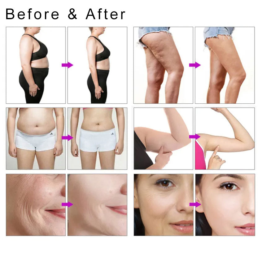 V9 Vacuum RF Cavitation Roller Vela Body Shape Slimming Machine Cellulite Remover