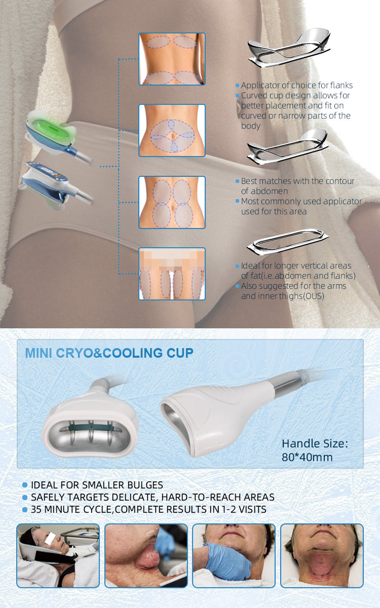 Portable Double Chin Cryo Cryolipolyse 360 Cryolipolysis Slimming Machine Criolipolisis Cool Fat Freezing Sculpting Machine