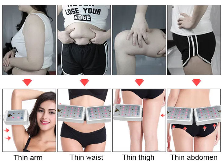 Cool Lipolysis Machine 208 Diodes Lipo Laser Belly Slimming