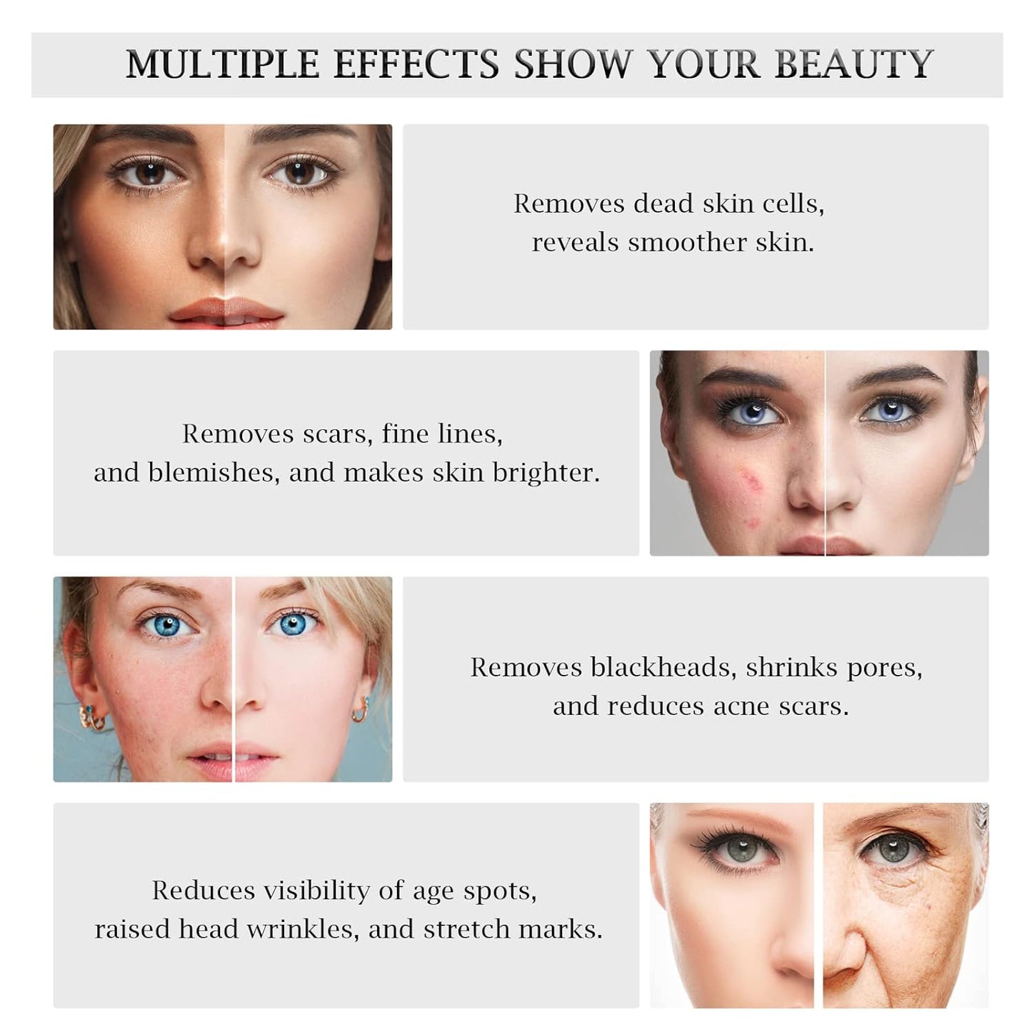 3 in 1 Diamond Microdermabrasion Machine with Vacuum Spray Beauty Facial Skin Care Dermabrasion Equipment for Salon Personal Home Use